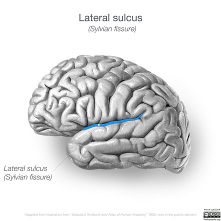 <p>Separates temporal lobe from parietal + frontal lobes</p>