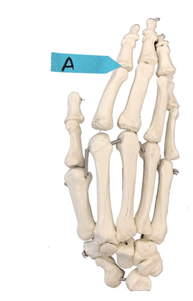 <p>Identify the joint.</p>