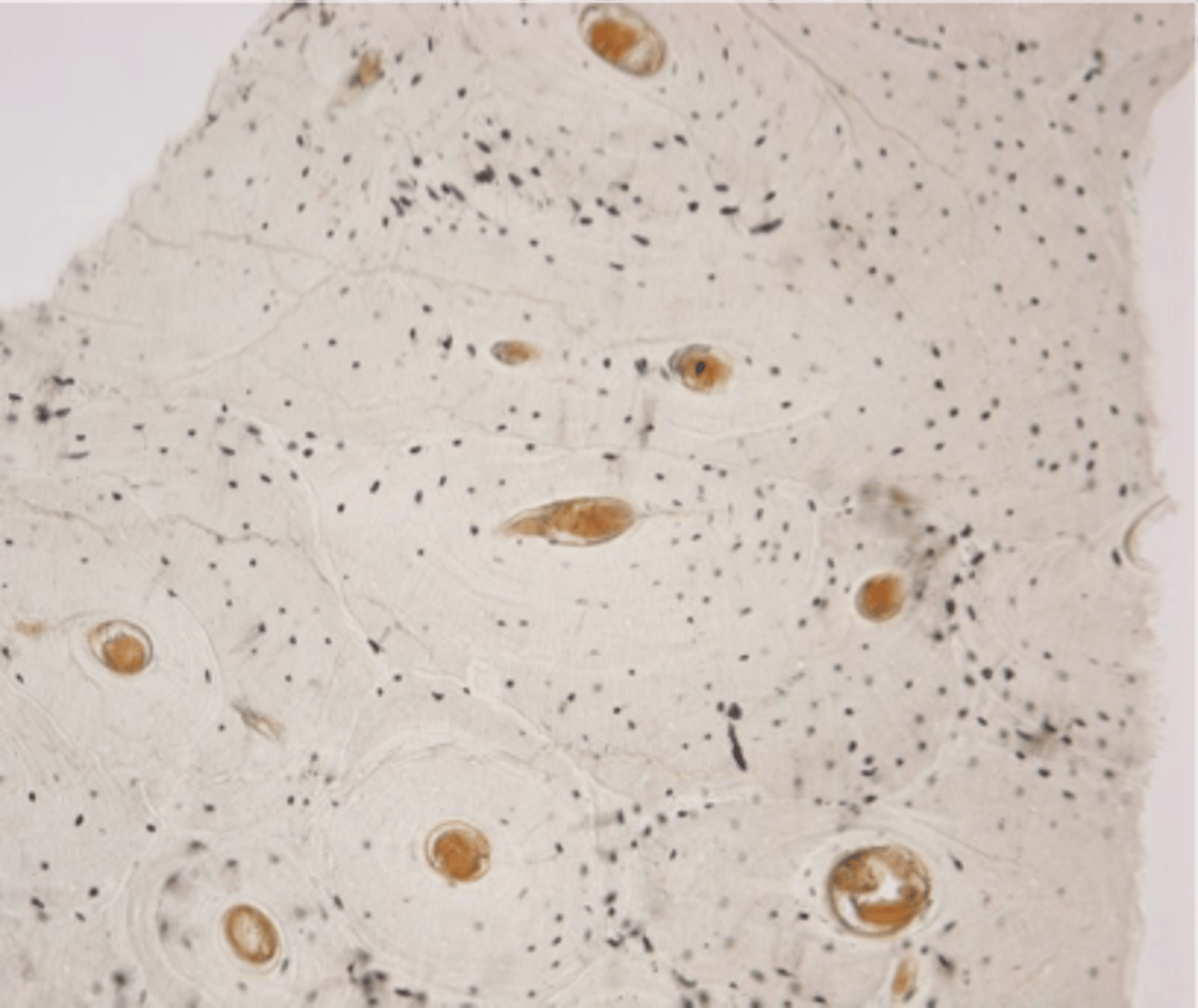 <p>Unstaid tissue and cells are difficult to examine.</p>