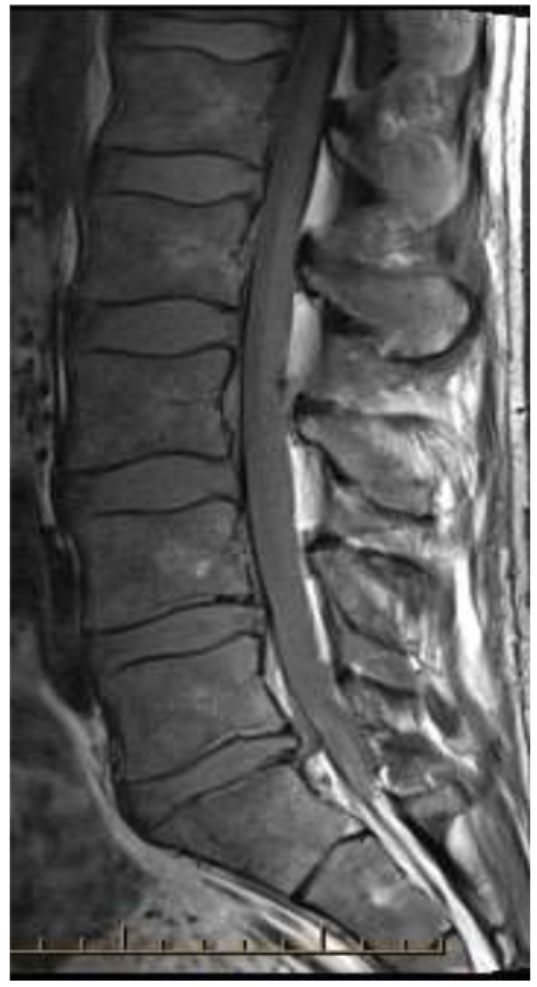 <p>What is the image weighting of this slice?</p>