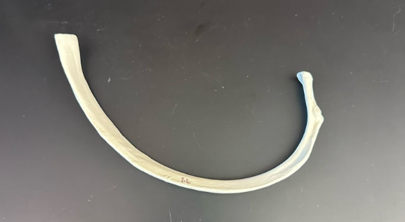 <p>What is this bone?</p>