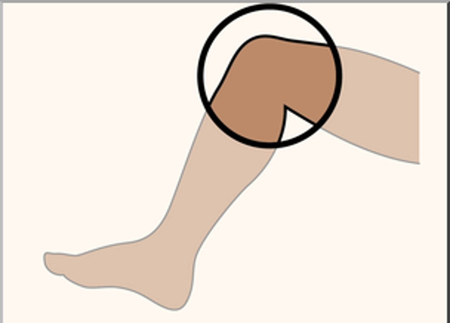 <p>la rodilla</p>