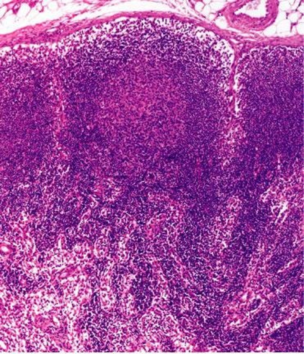 <p>Small, bean-shaped structures that filter lymph and contain immune cells to help fight infection.</p>