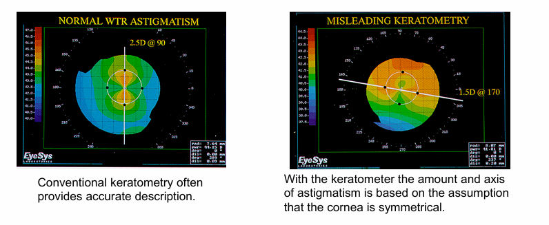 <p>Keratometry samples 2 points in each two meridians (total of 4 points) &amp; estimates the best spherical surface through these two points</p><p>Corneal topography samples thousands of points allowing the reconstruction of the corneal surface</p>