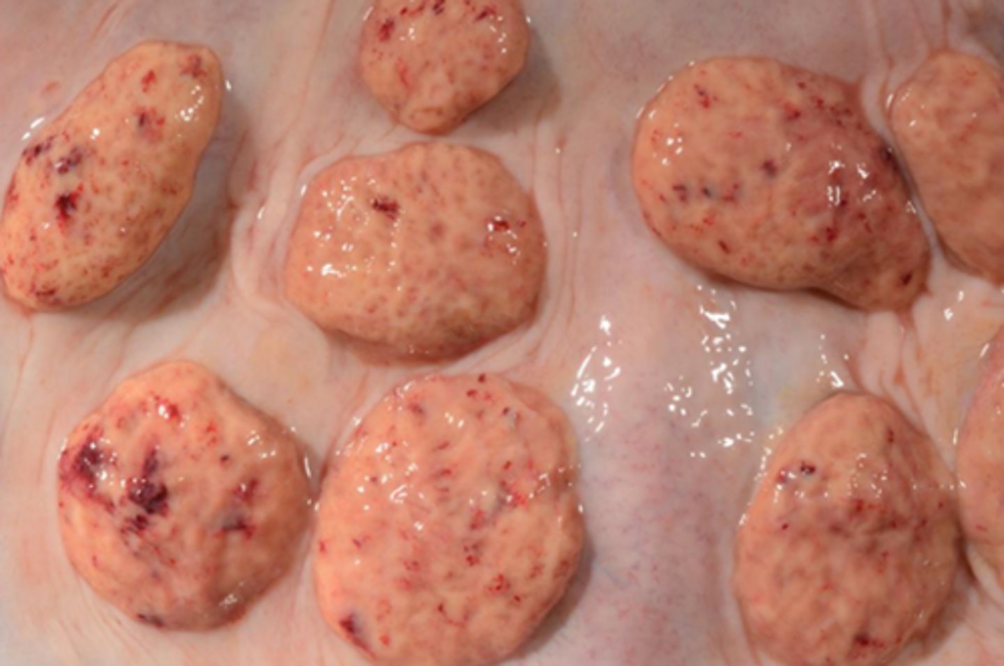 <p>______-pregnancy</p>