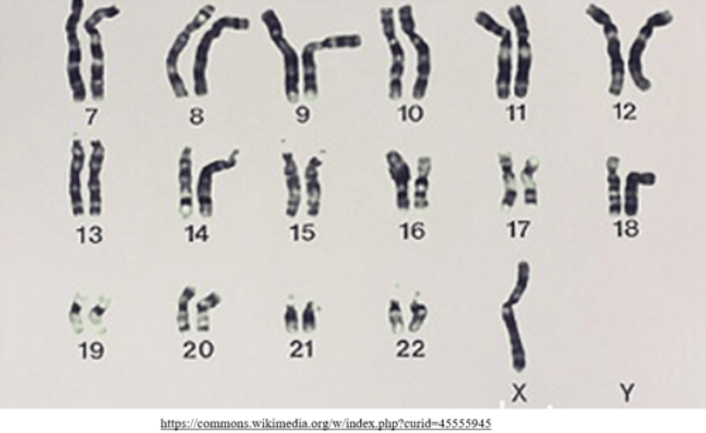 <p>monosomy</p><p>(ex: monosomy X = Turner syndrome)</p>