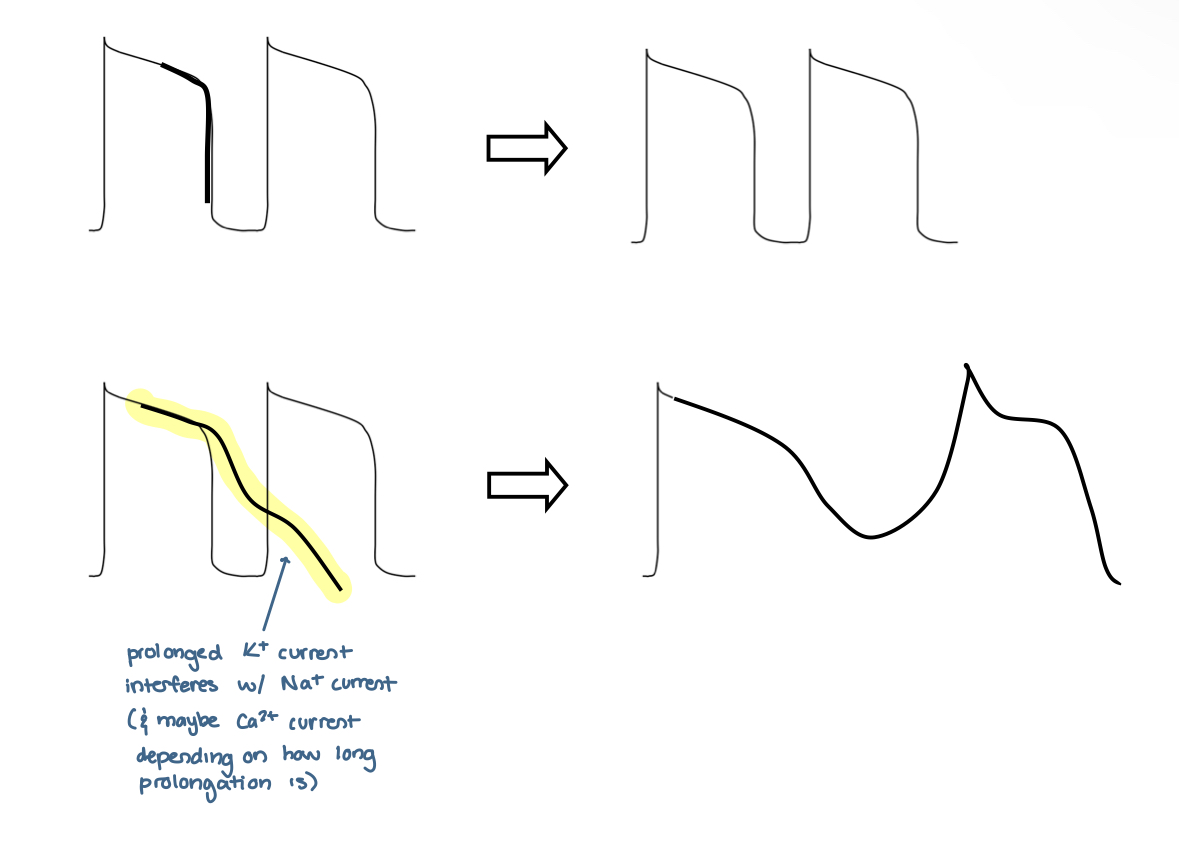 <p>caused by abnormal/prolonged K+ current; trigger abnormal Na+ and/ or Ca2+ currents (Na+/Ca2+ exchanger)</p>