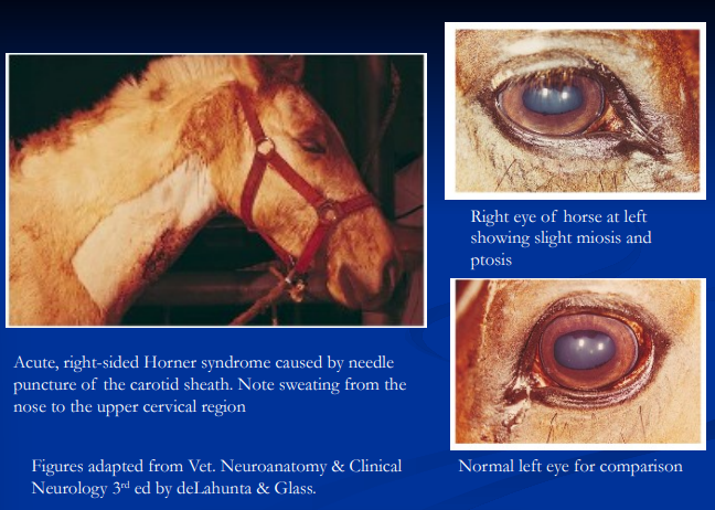 <p><span style="background-color: transparent;"><strong>Horner Syndrome</strong></span></p>