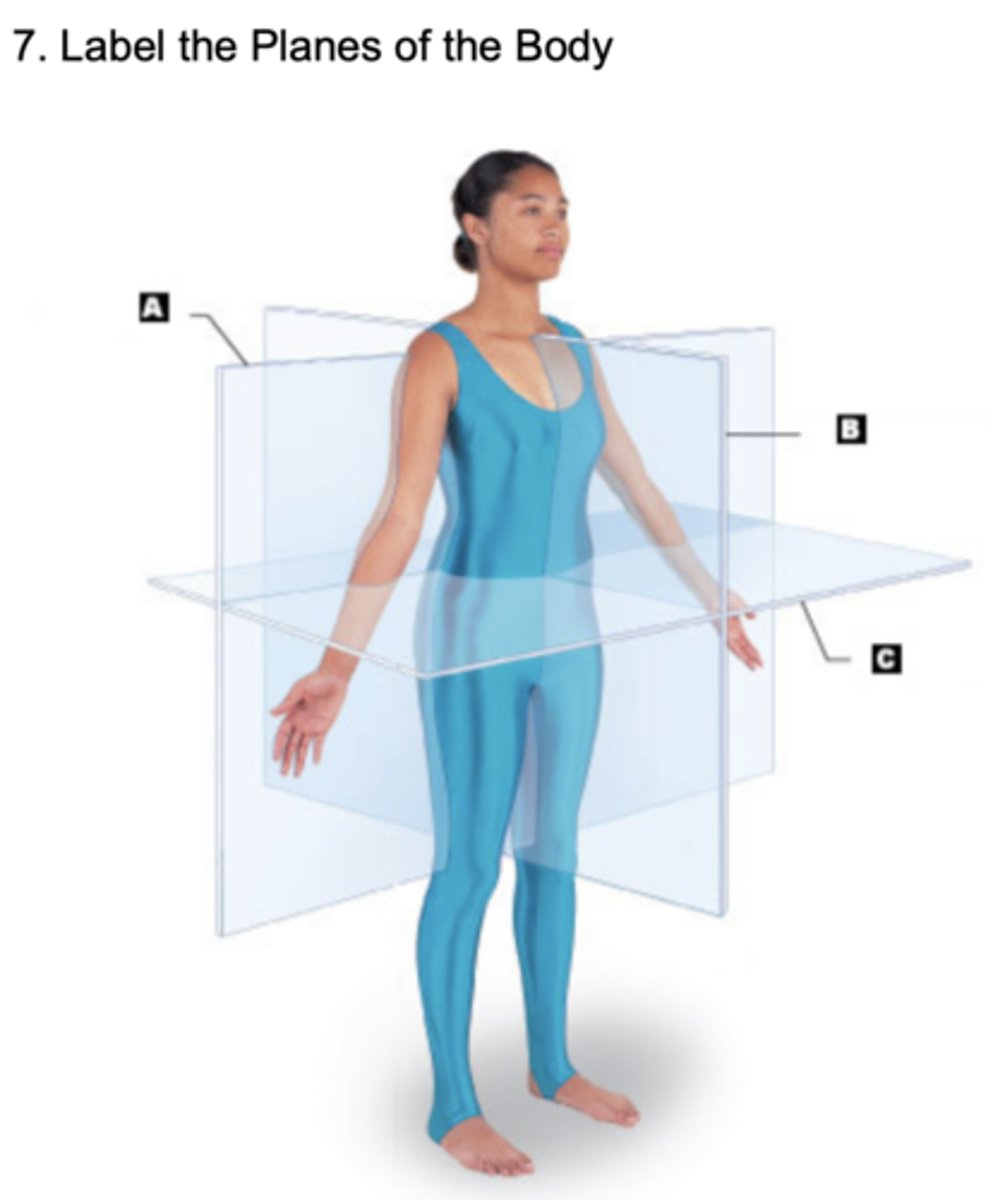 <p>Transverse Plane</p>