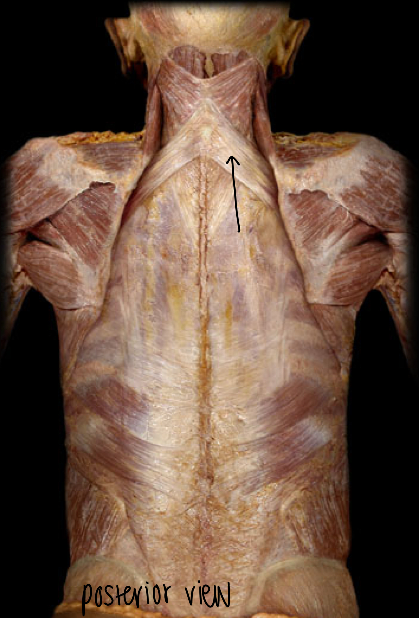 <p>What m. is this?</p><p>Orientation and action</p>