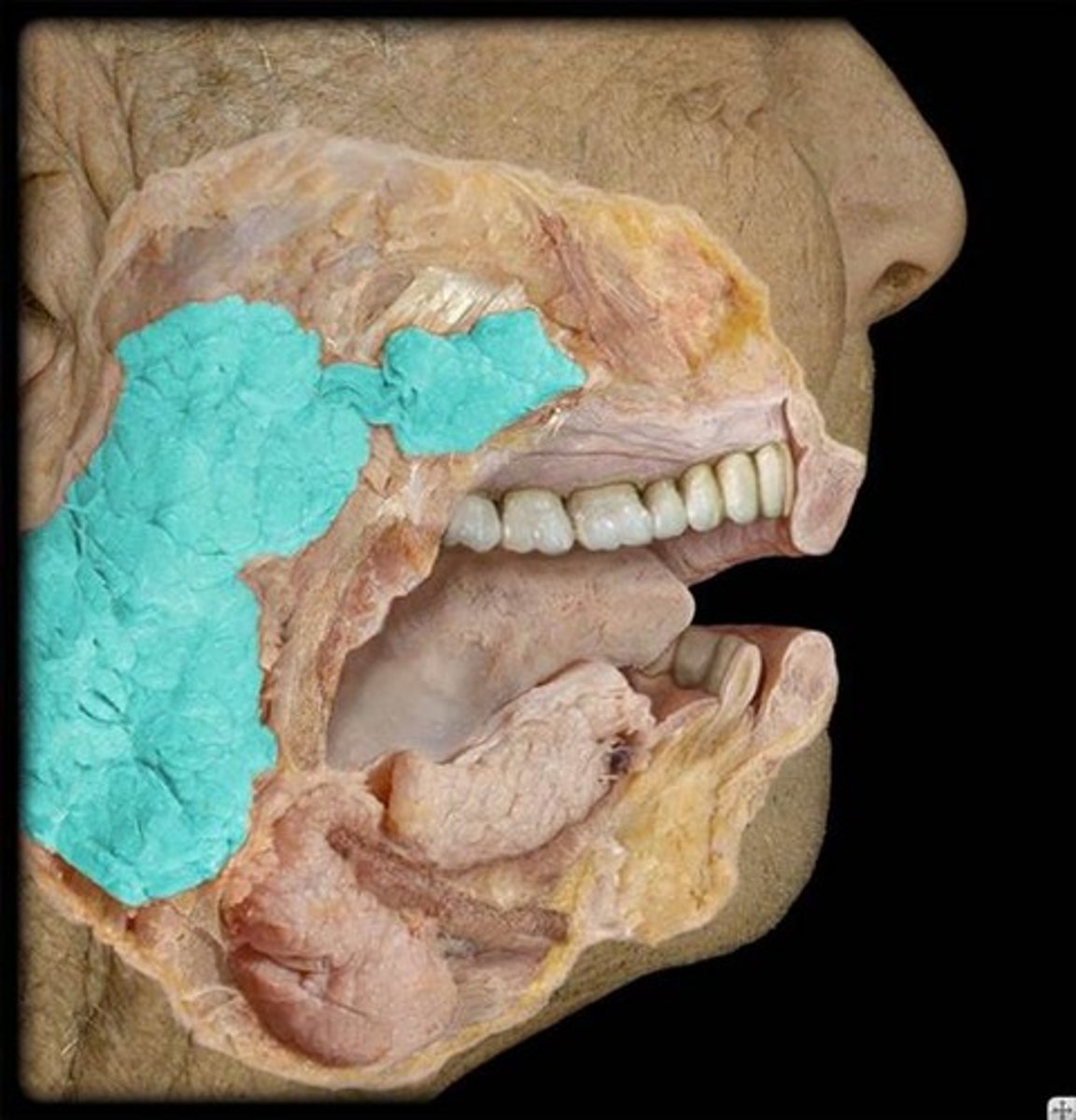 <p>Identify this specific structure.</p>