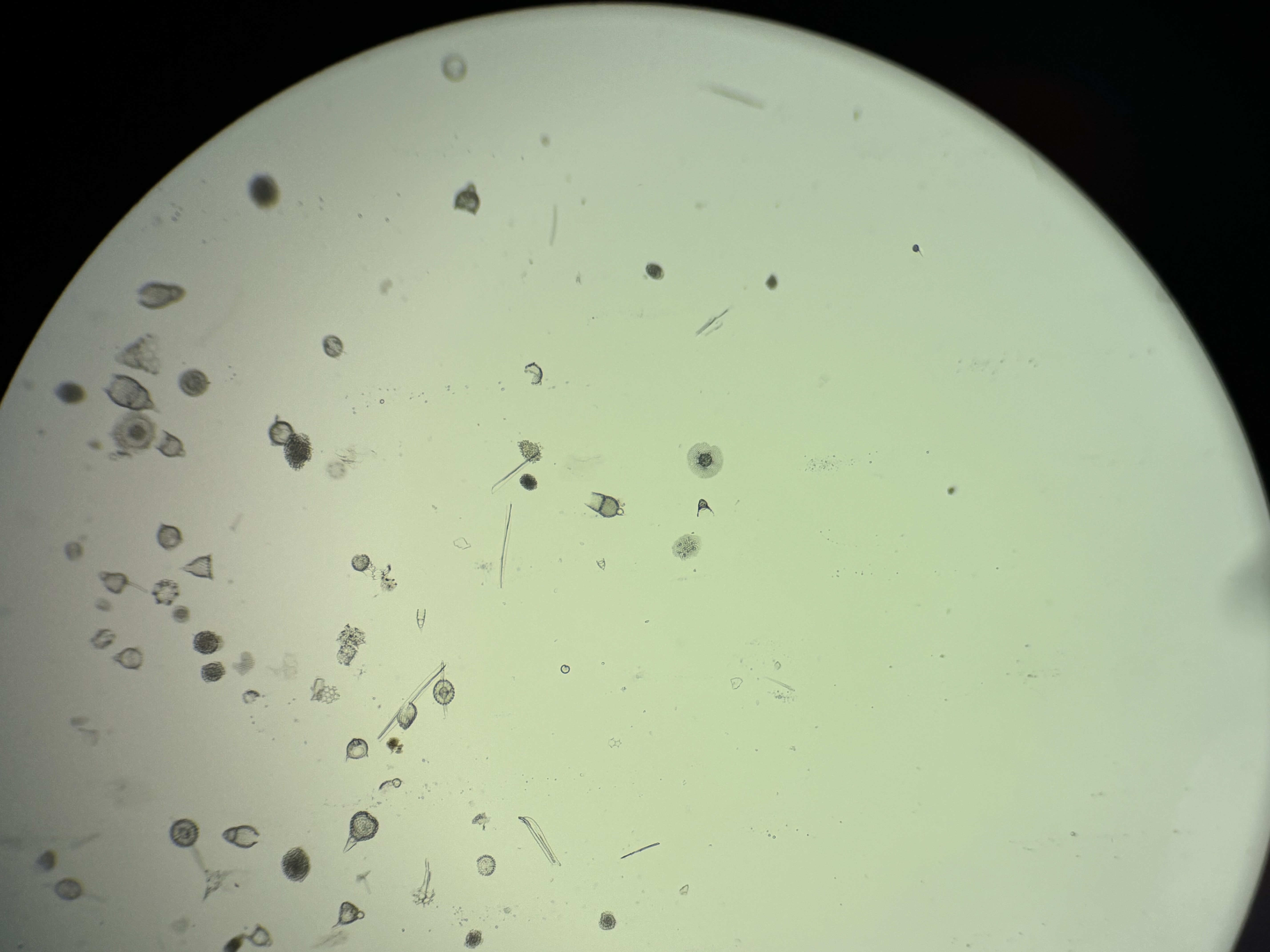 <p>Radiolaria strew</p>