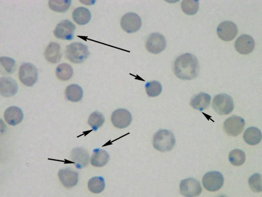 <p>Identify this type of red cell.</p>