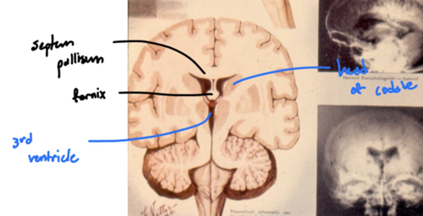 <p>thalamus and hypothalamus</p>