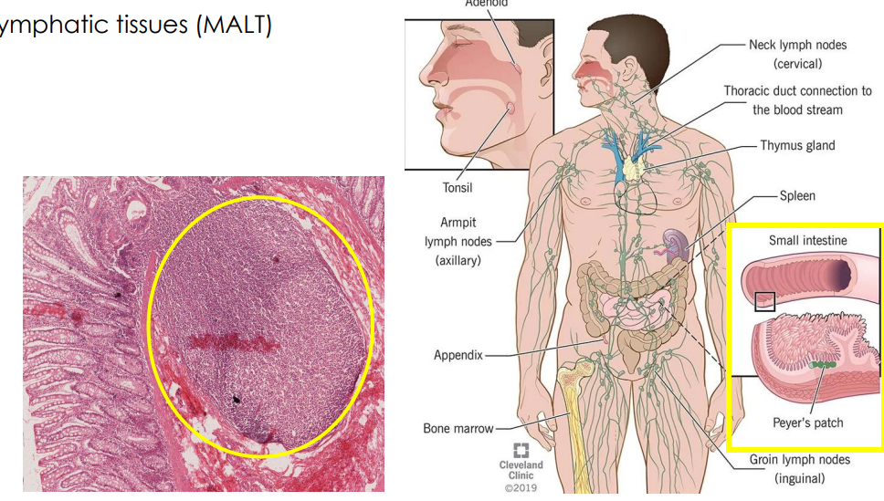 <p>Secondary: MALT</p>