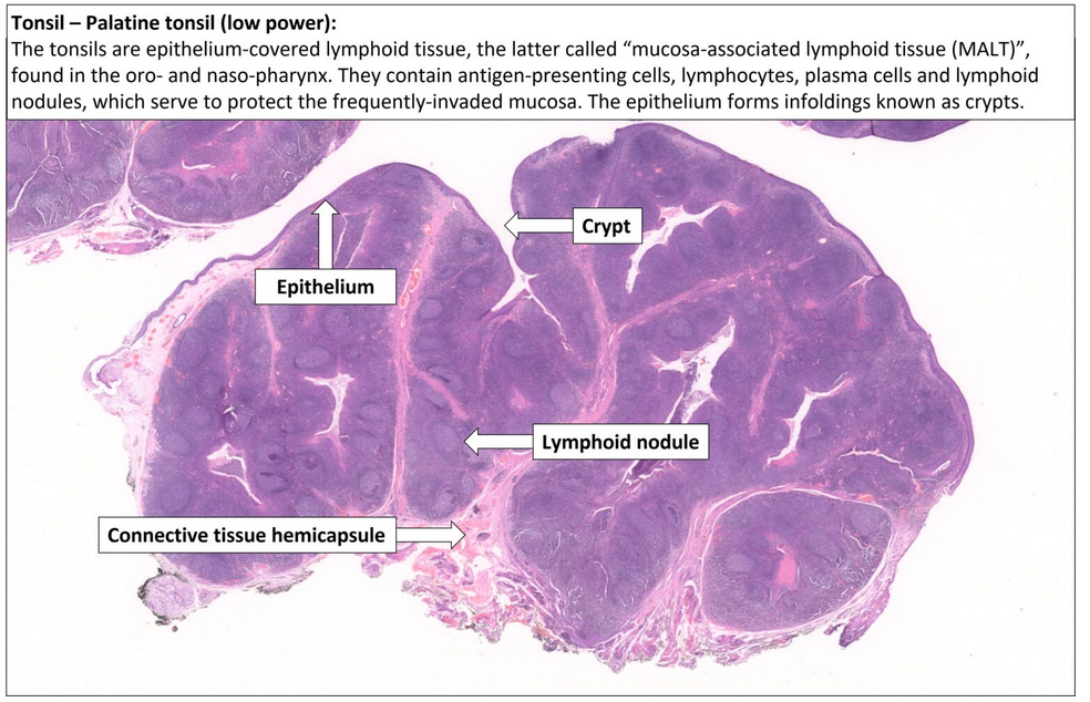 <p>What are the histological <strong>features of tonsils?</strong></p>