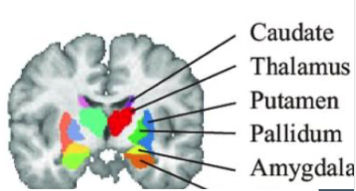 <p>grey matter areas</p><p>not part of cortex, islands within white matter </p>