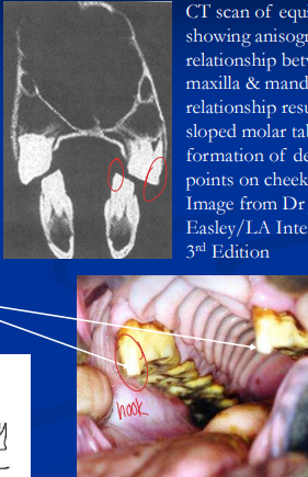 <p><span style="background-color: transparent;">Routine Dental Care</span></p>