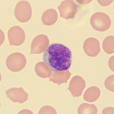 <p>What is this leukocyte?</p>