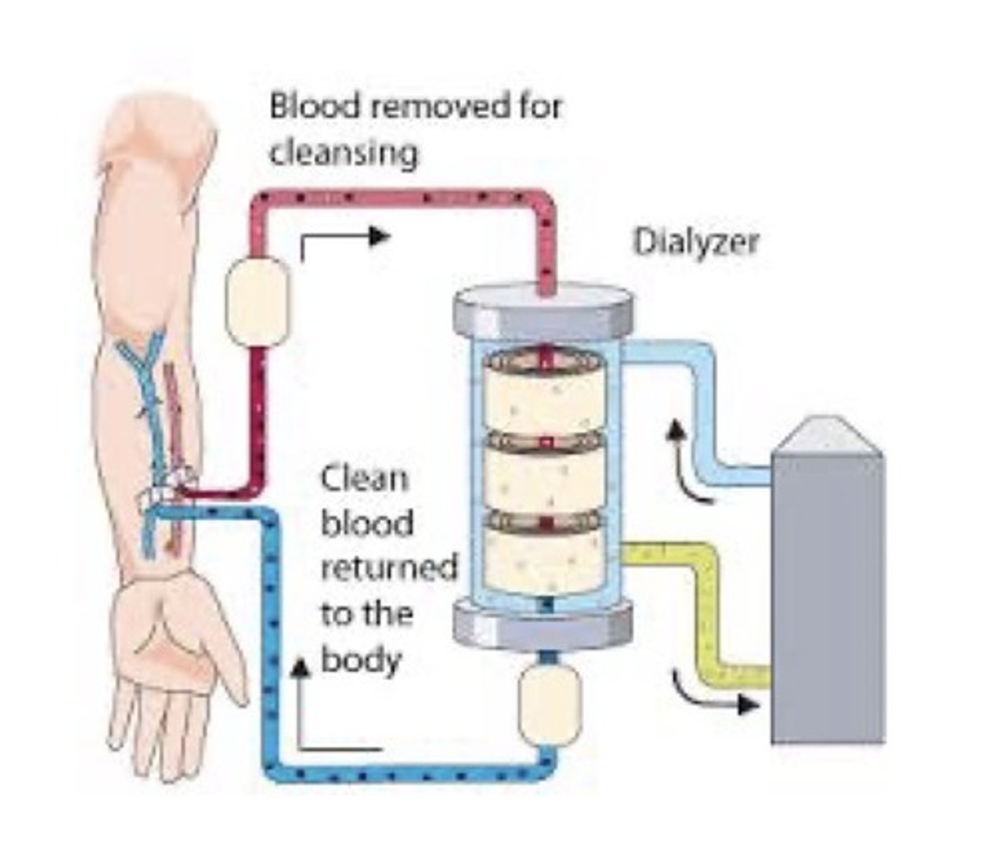 <p>Most dialysis patients (80%) in the US receive this type of dialysis. —————————— is the method of choice when azotemia occurs and dialysis is needed on a long-term basis. Treatments are performed every 2-3 days and usually 3-4 hours is required for each session.</p>