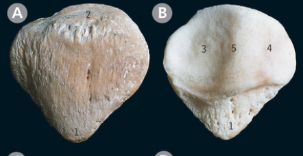 <p>What surface of the patella is B</p>