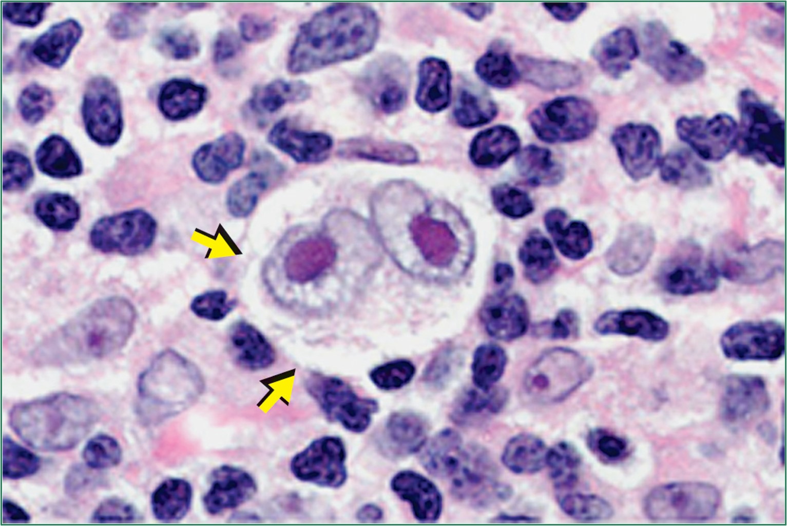 <p>What kind of cell is this?</p>