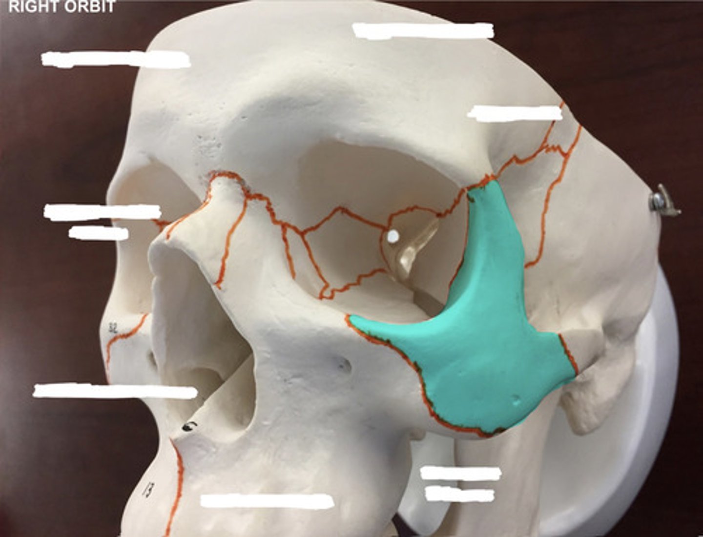 <p>What bone is highlighted here?</p>