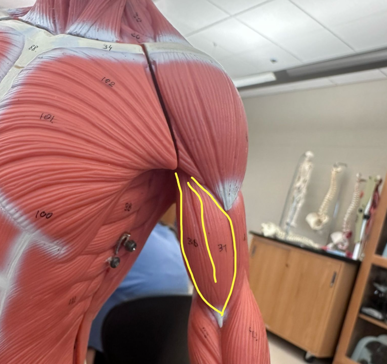 <p>What muscle is the yellow line indicating? What action does this muscle perform?</p><p>What is the origin and insertion of this muscle?</p>