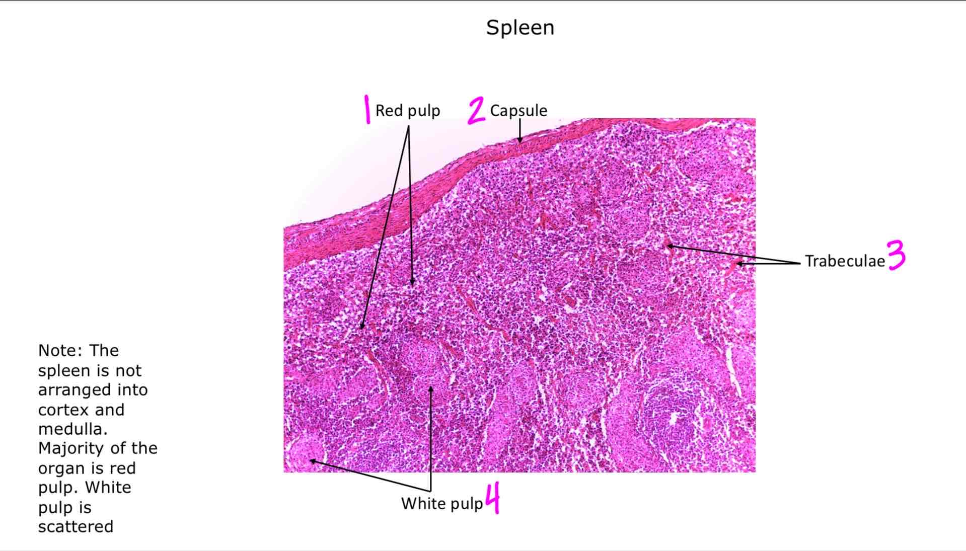 <ol><li><p>Red pulp</p></li><li><p>Capsule</p></li><li><p>Trabeculae</p></li><li><p>White pulp</p></li></ol>