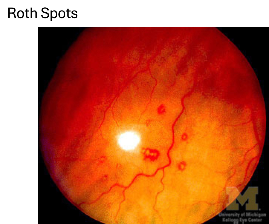 <p>roth spots</p>