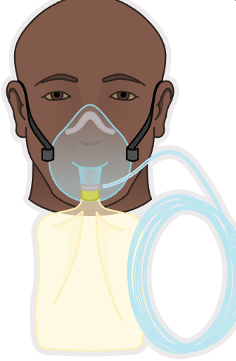 <p><strong>Nonrebreather Mask</strong></p>