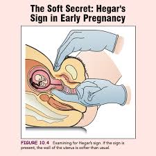 <p>softening and compressibility of the lower uterine segment (isthmus) just above the cervix </p>