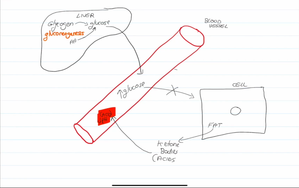 <ul><li><p>Excessive sugar in the blood causes the blood to thicken.</p></li><li><p>Fats use lipids for energy, which leads to the formation of ketones, ketones can leak into the blood and alter blood pH.</p></li><li><p>Untreated ketoacidosis can lead to coma and death</p></li></ul><p></p>