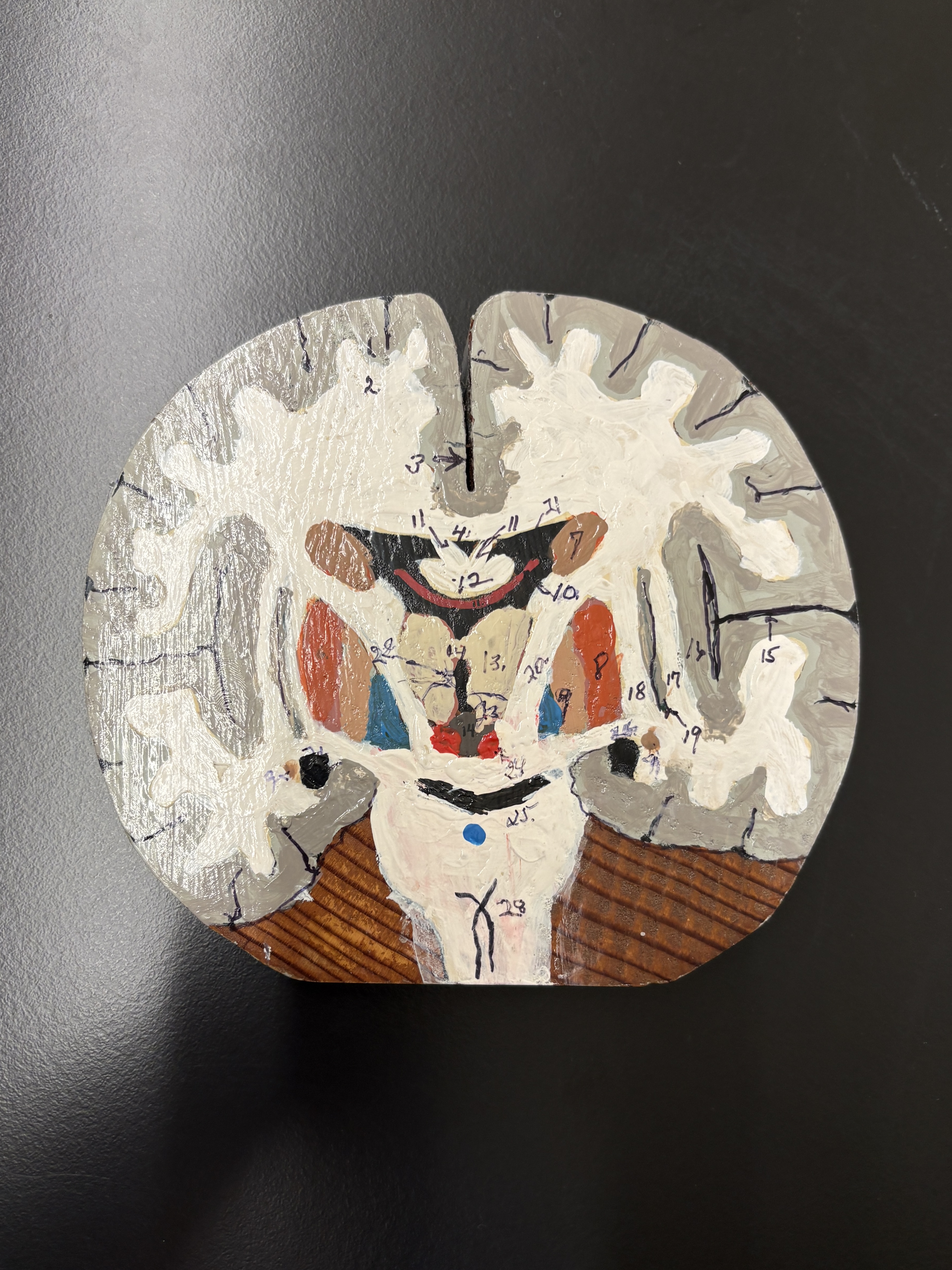 <p>label parts of coronal section of brain</p>