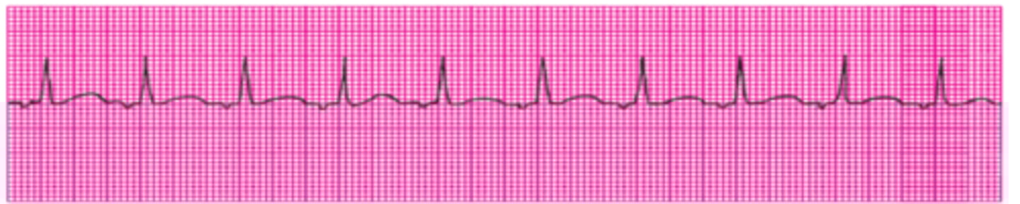 <p>Name this rhythm.</p>