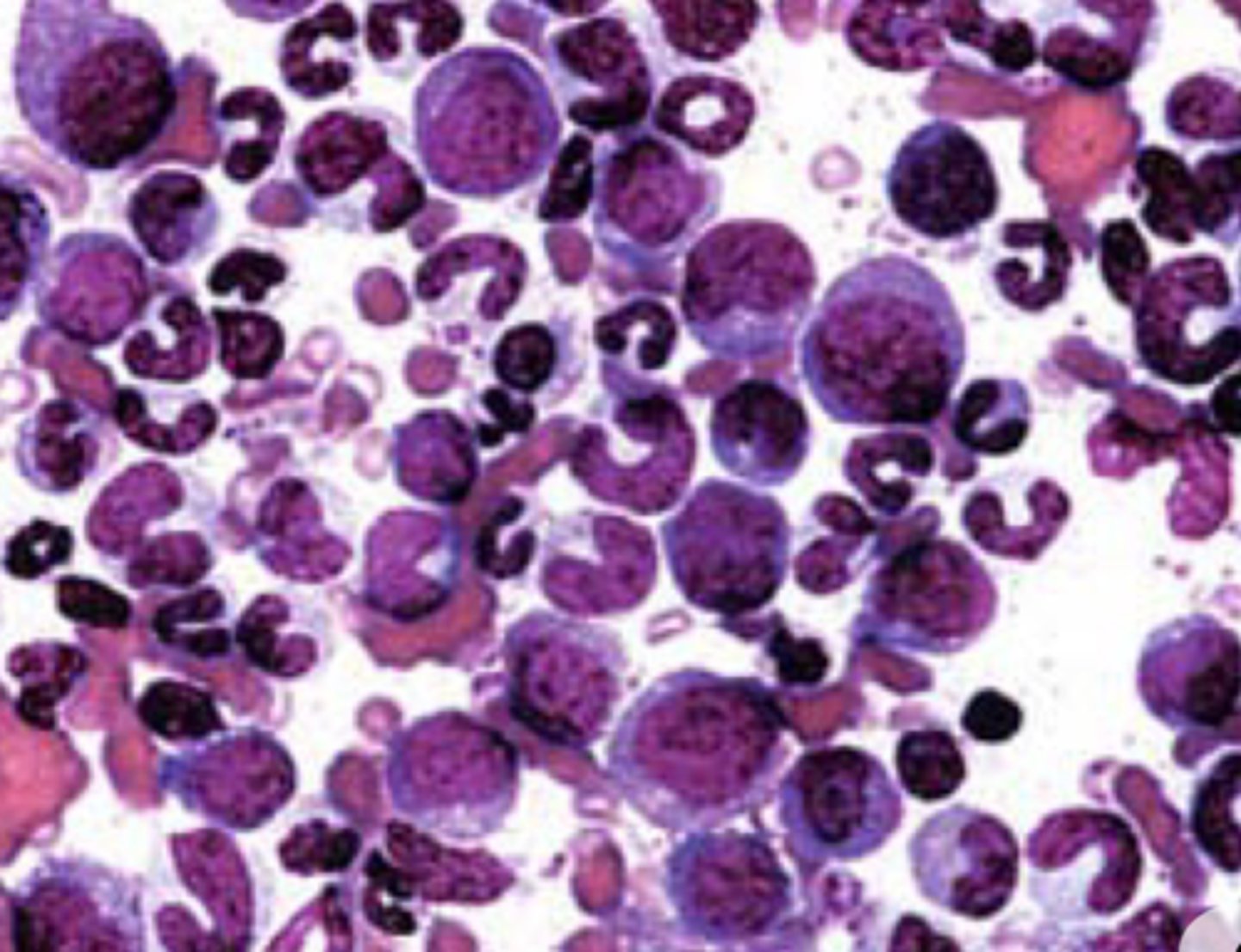 <p>- Individual cell detail, maturation, dysplastic and neoplastic changes to cells</p><p>- Limited in that the sample must be representative (e.g. not just peripheral blood)</p>