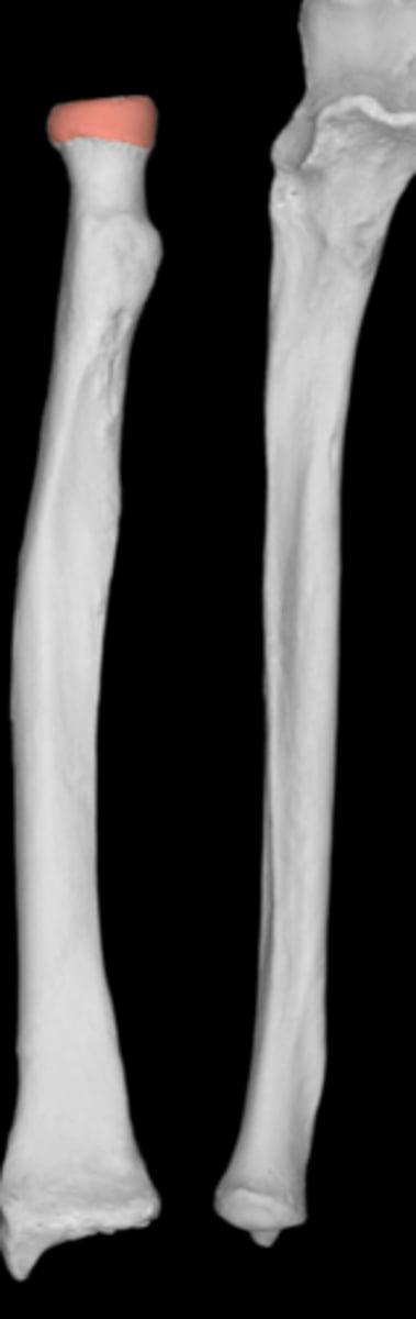 <p>proximal</p><p>disc shaped</p><p>articulates with capitulum and ulna</p>