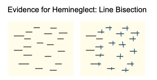 Participants were asked to look at a line and cut it in half, results shown below, actual patient image on the right
