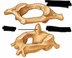 <p>which type of vertebrae are these?</p>