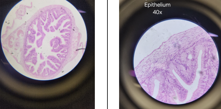 <p>Name this lab epithelium: focus in center of 40x</p>