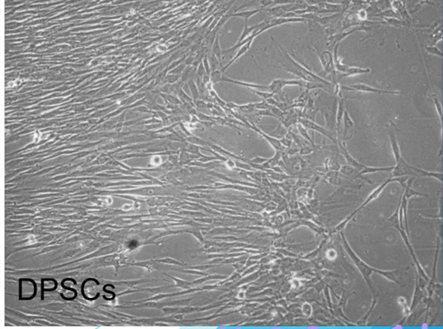 <p>fibroblast-like, neural crest-derived mesenchymal stem cells found in perivascular niches of the cell-rich zone of the pulp &amp; in pulp core of permanent tooth (1st &amp; most studied dental stem cells)<br> - multipotent<br> -greater proliferation rate than BMSCs (bone marrow stem cells)<br> - more suitable than BMSCs for mineralized tissue regeneration<br> - demonstrate chondrogenic potential in virto (can become a chondrocyte)<br><br>*will migrate out niche &amp; differentiate into odontoblasts upon damage &amp; forms more nerves &amp; blood vessels to further repair the pulp</p>