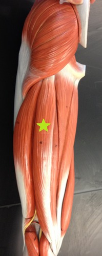 <p>Identify the Muscle.</p>