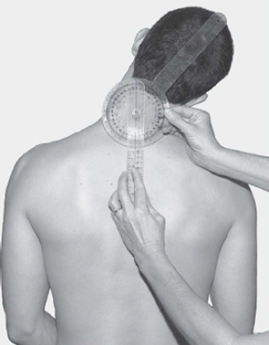 <p>fulcrum: spinous process C7<br>proximal: along spinous processes of thoracic vertebrae / perpendicular to ground<br>distal: dorsal midline of head<br><br>normal = 45</p>