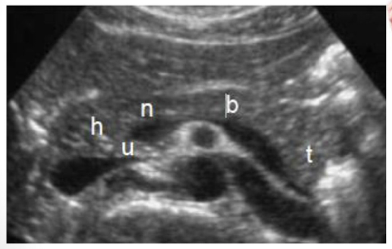 <p>Be able to identify this image taken in a transverse plane</p>