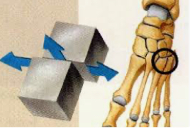 <p>ROM is gliding </p><p>Intercarpal joints of wrist/AC unit </p>