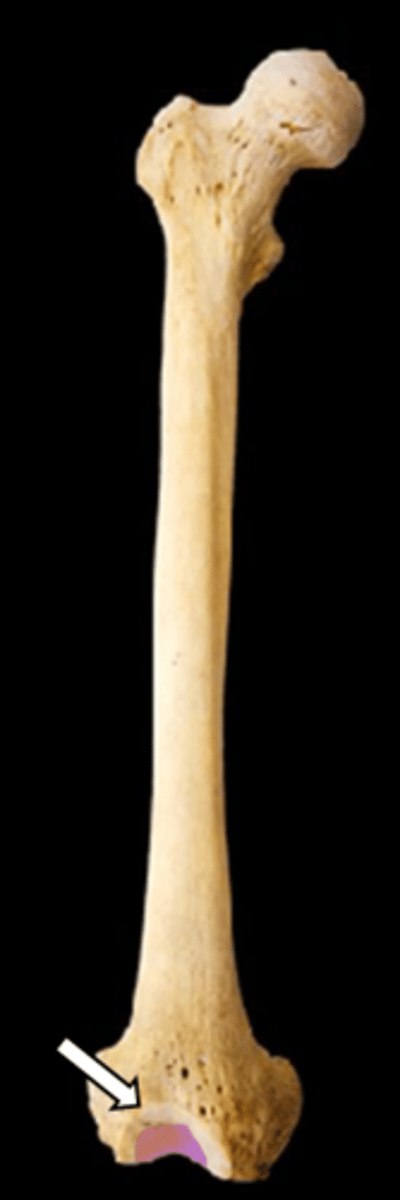 <p>name the part</p>