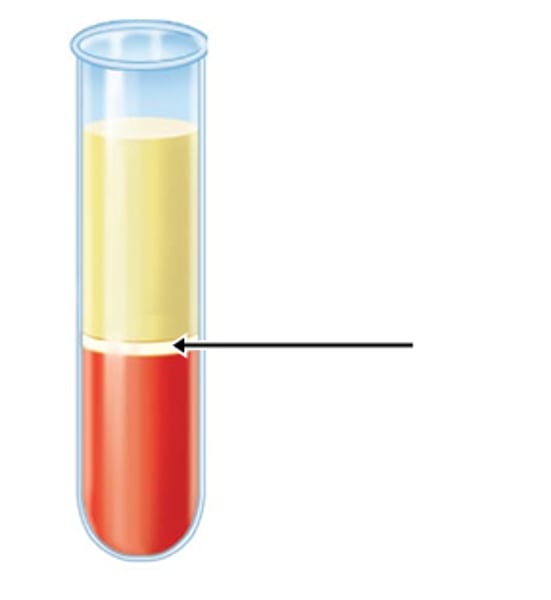 <p>thin, pale layer of leukocytes and platelets that separates the erythrocytes from the plasma in a sample of centrifuged blood</p>