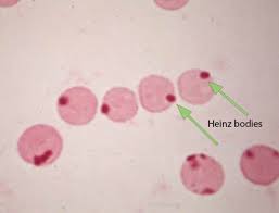 <p>Heinz body anemia, hemolysis, hemoglobinuria</p>
