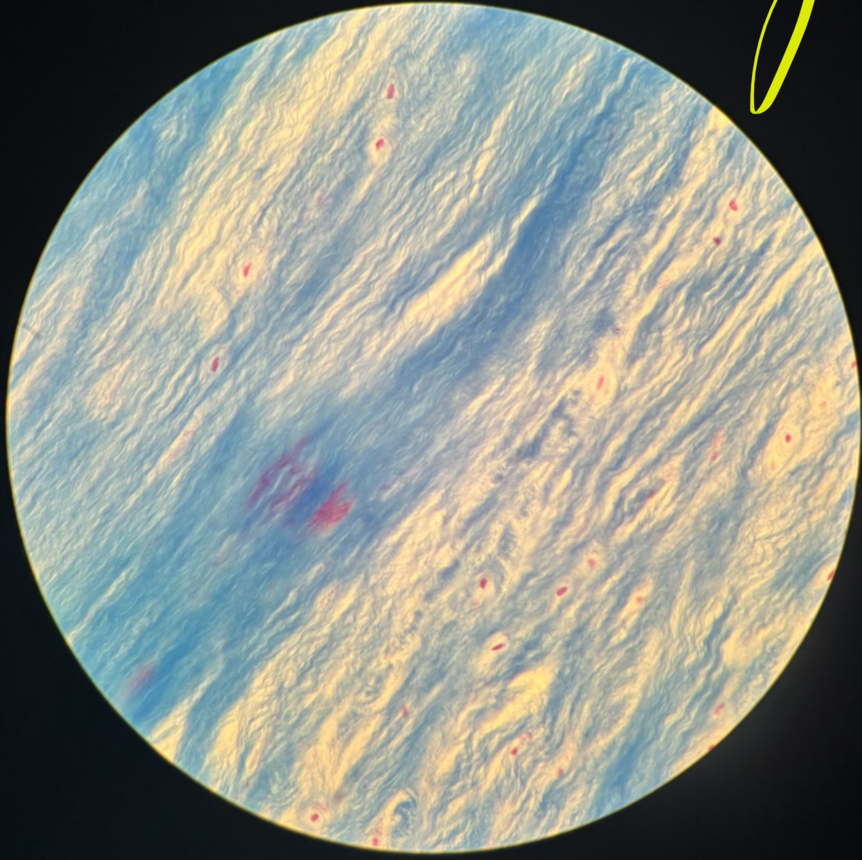 term image