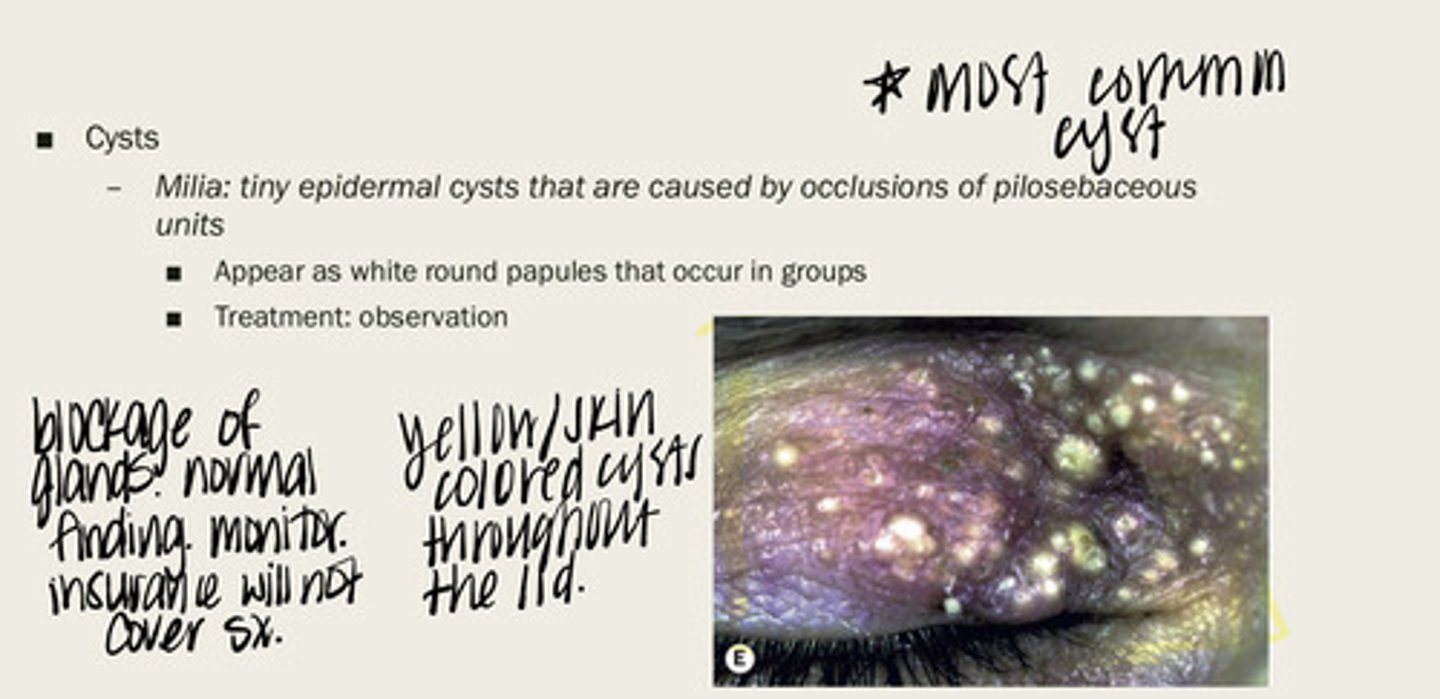 <p>What do milia cysts appear (present) as?</p>